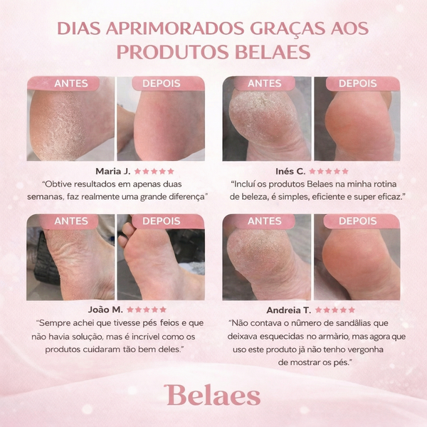 RaspaCalos Elétrico Pro Fácil Portátil Rápido